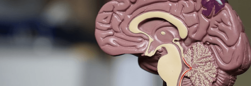 Brain model